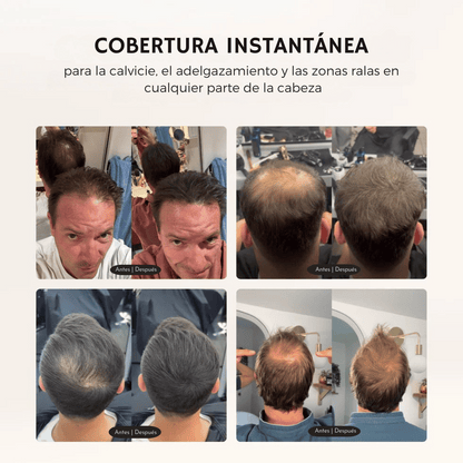 Camuflaje capilar